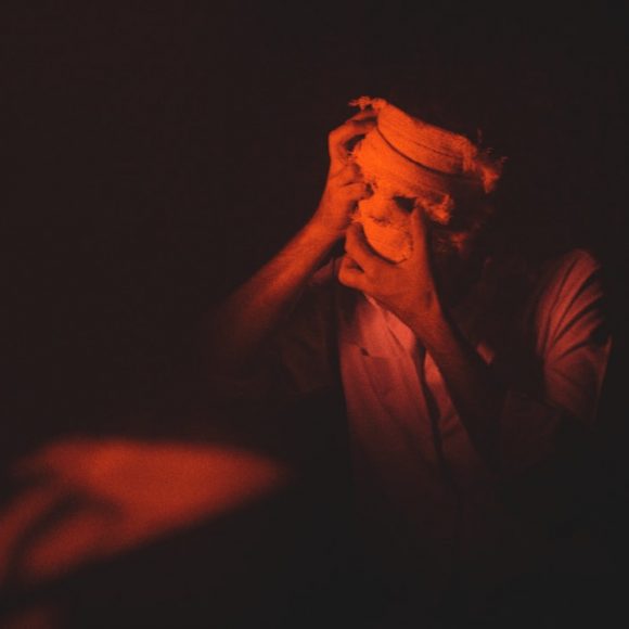 Photo stress management